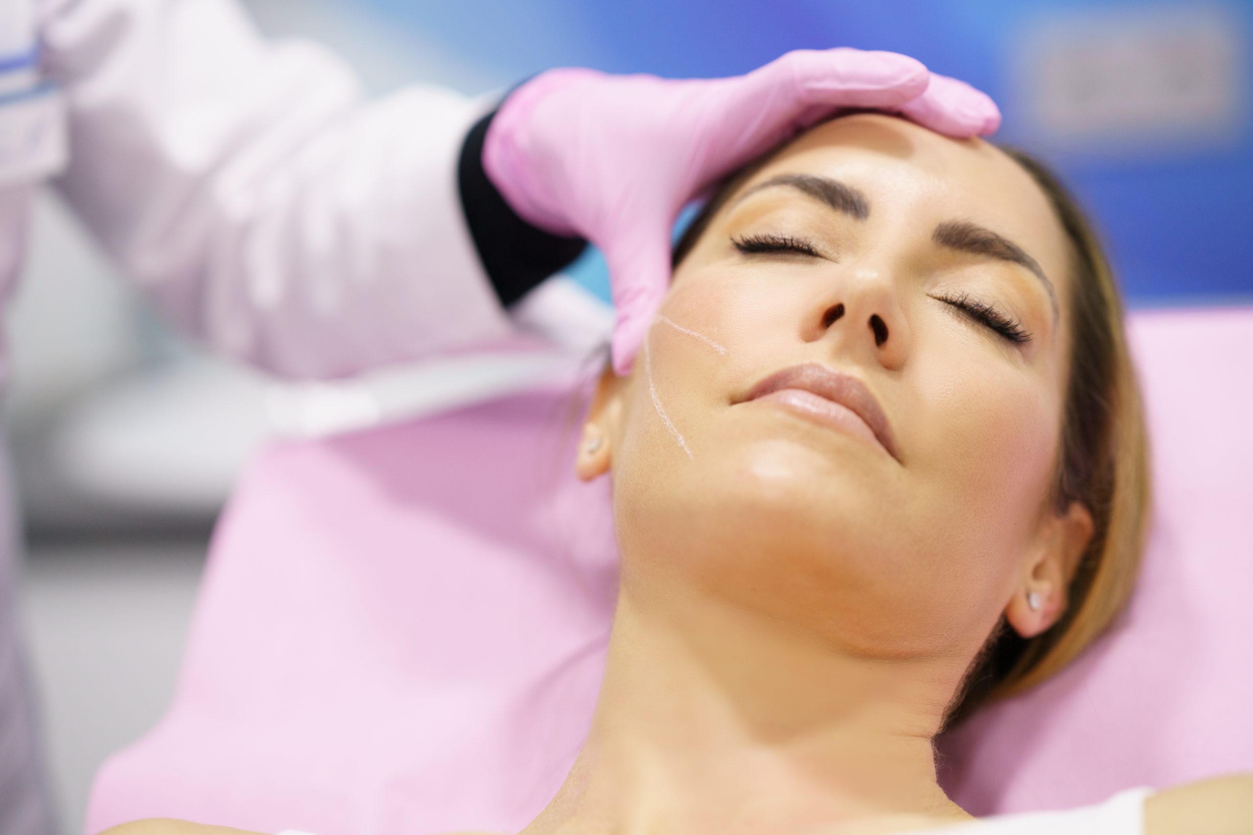 Doctor painting the area of a woman's face where the PDO suture treatment threads will be injected.