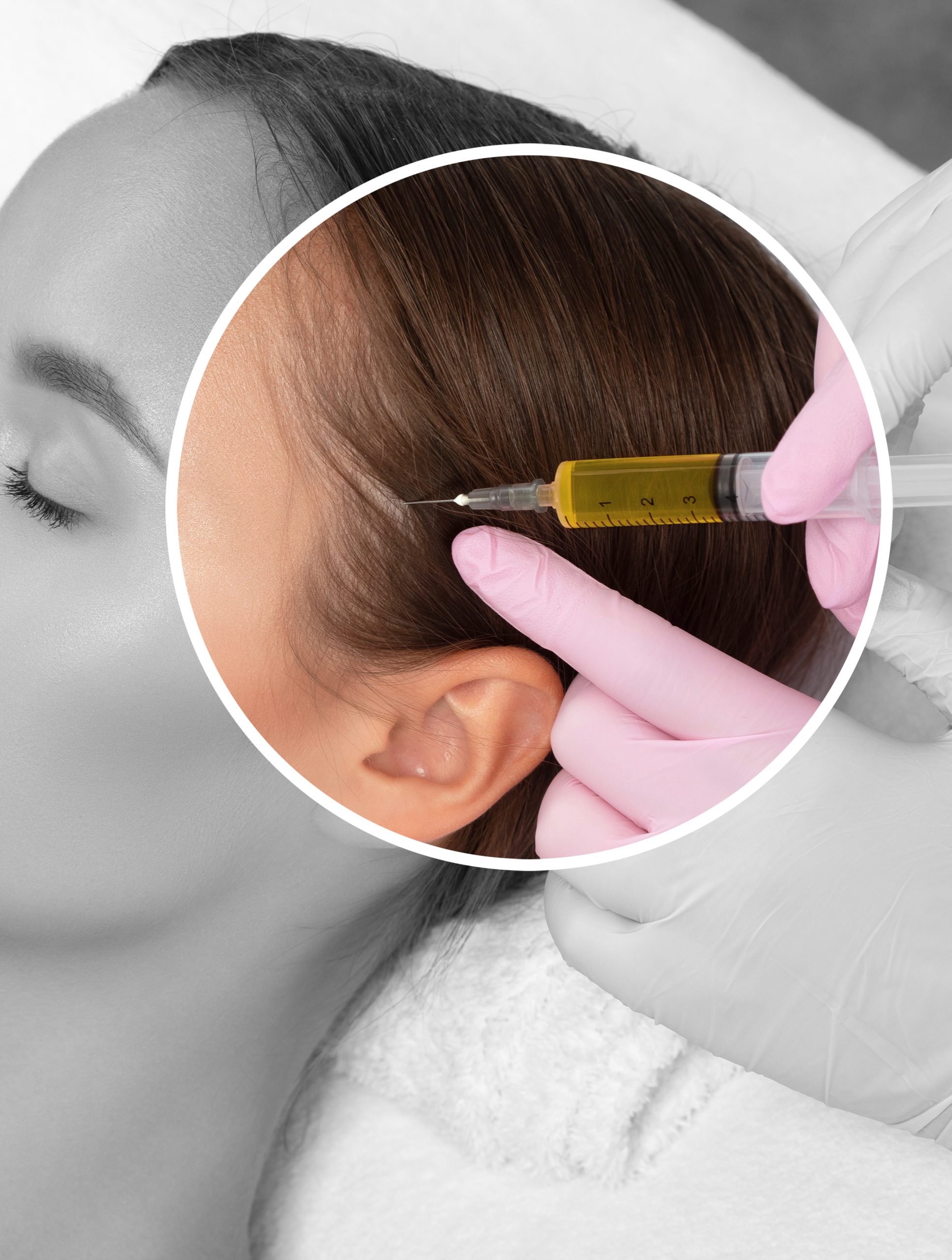 Cosmetologist does prp therapy against hair loss and anti-dandruff of a beautiful woman in a beauty salon. Cosmetology concept.