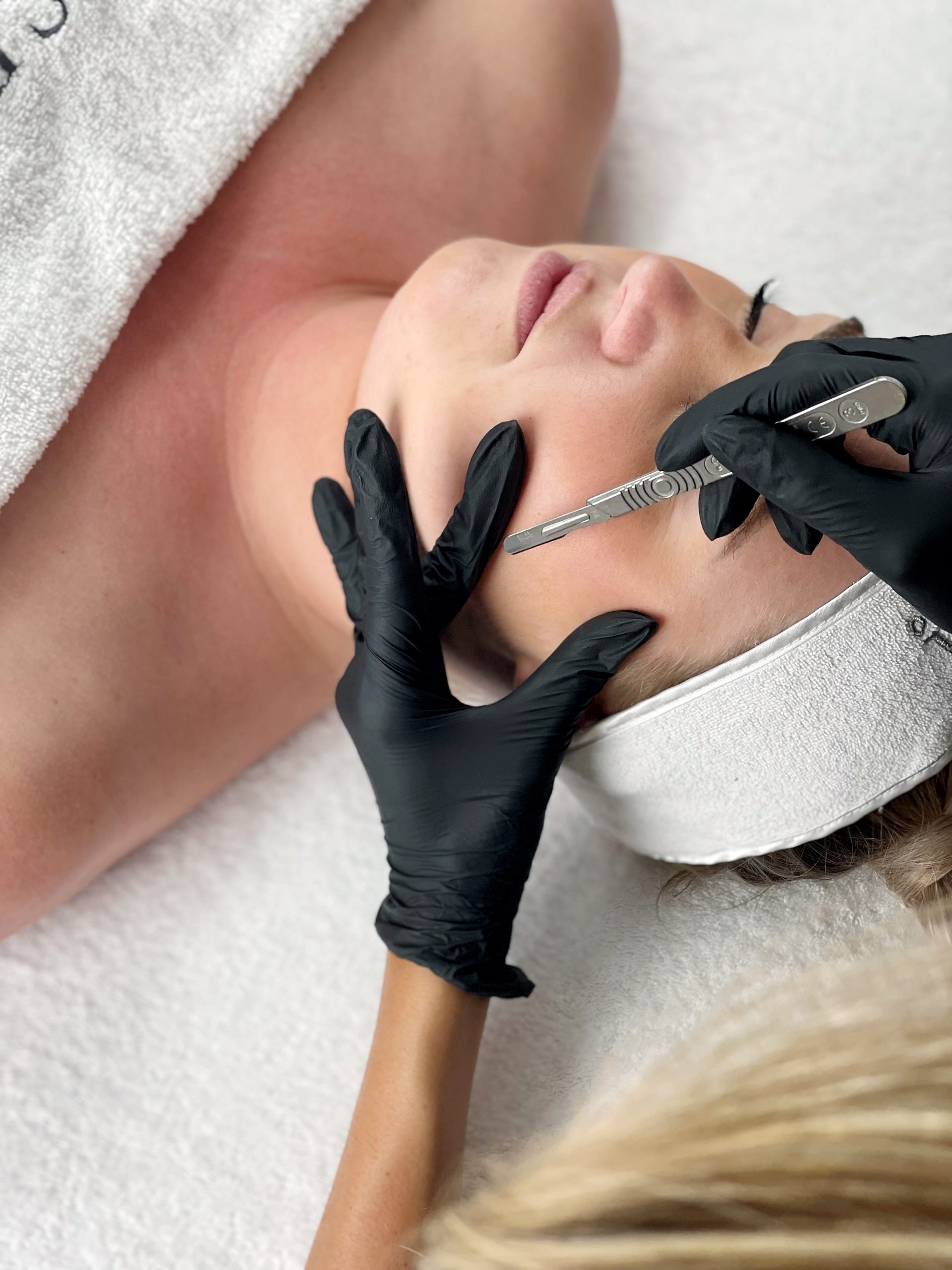 Dermaplaning 2